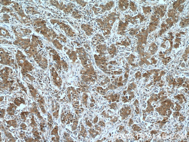 FOXO3A Antibody in Immunohistochemistry (Paraffin) (IHC (P))