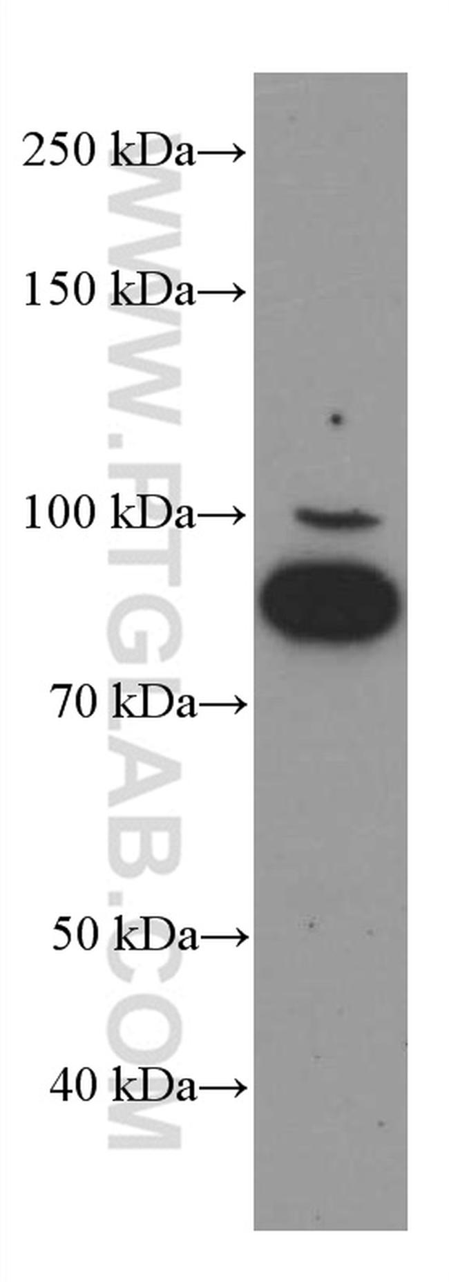 FOXO3A Antibody in Western Blot (WB)