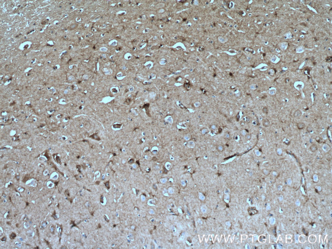 PKC gamma Antibody in Immunohistochemistry (Paraffin) (IHC (P))