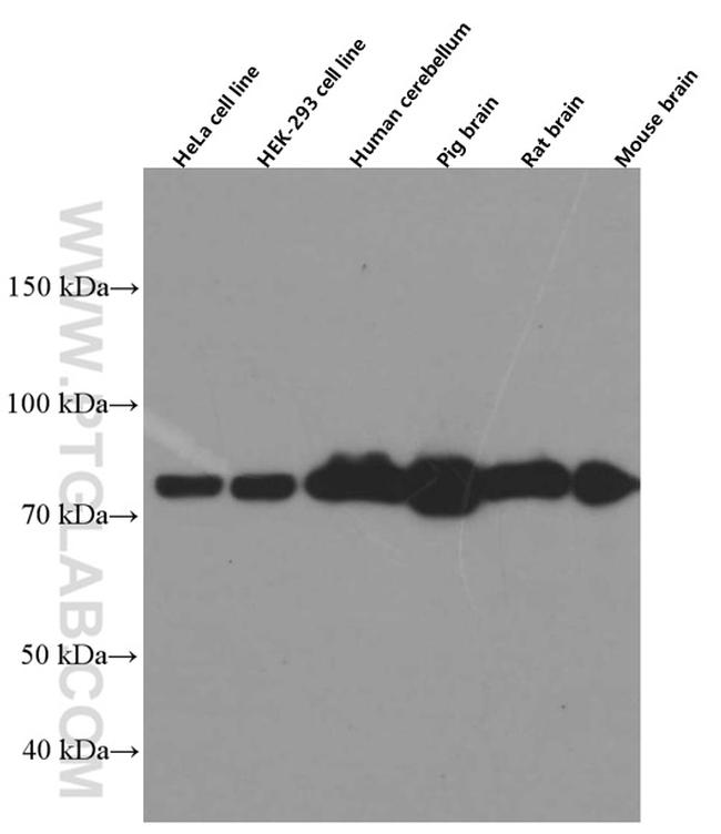 PKC gamma Antibody in Western Blot (WB)