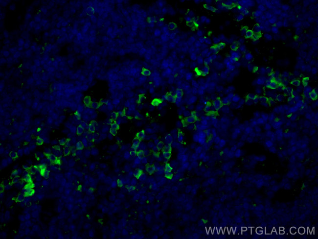 PLEK Antibody in Immunohistochemistry (PFA fixed) (IHC (PFA))