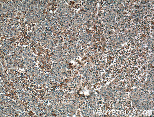 PLEK Antibody in Immunohistochemistry (Paraffin) (IHC (P))