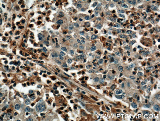 PLEK Antibody in Immunohistochemistry (Paraffin) (IHC (P))