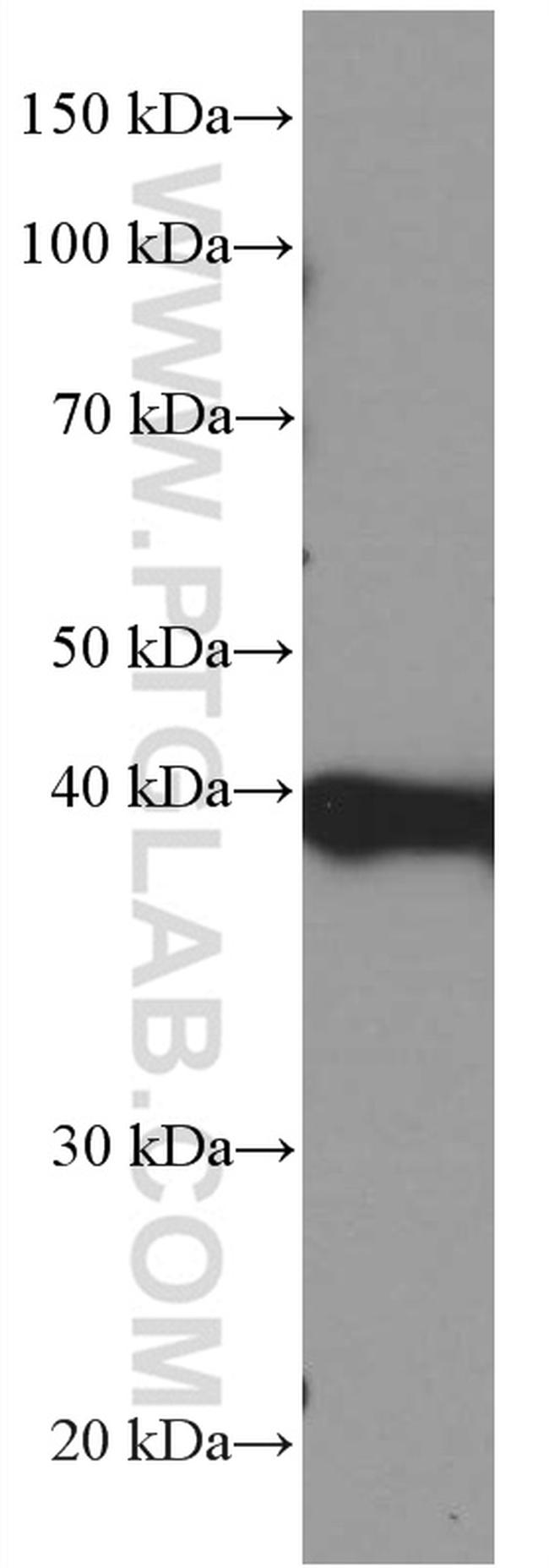 PLEK Antibody in Western Blot (WB)