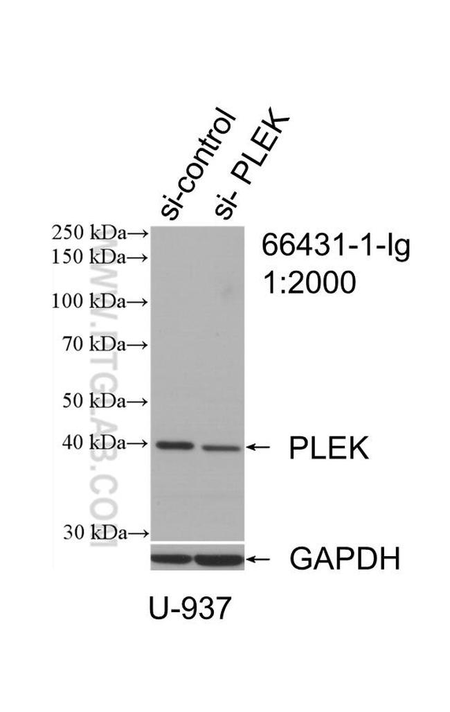 PLEK Antibody in Western Blot (WB)