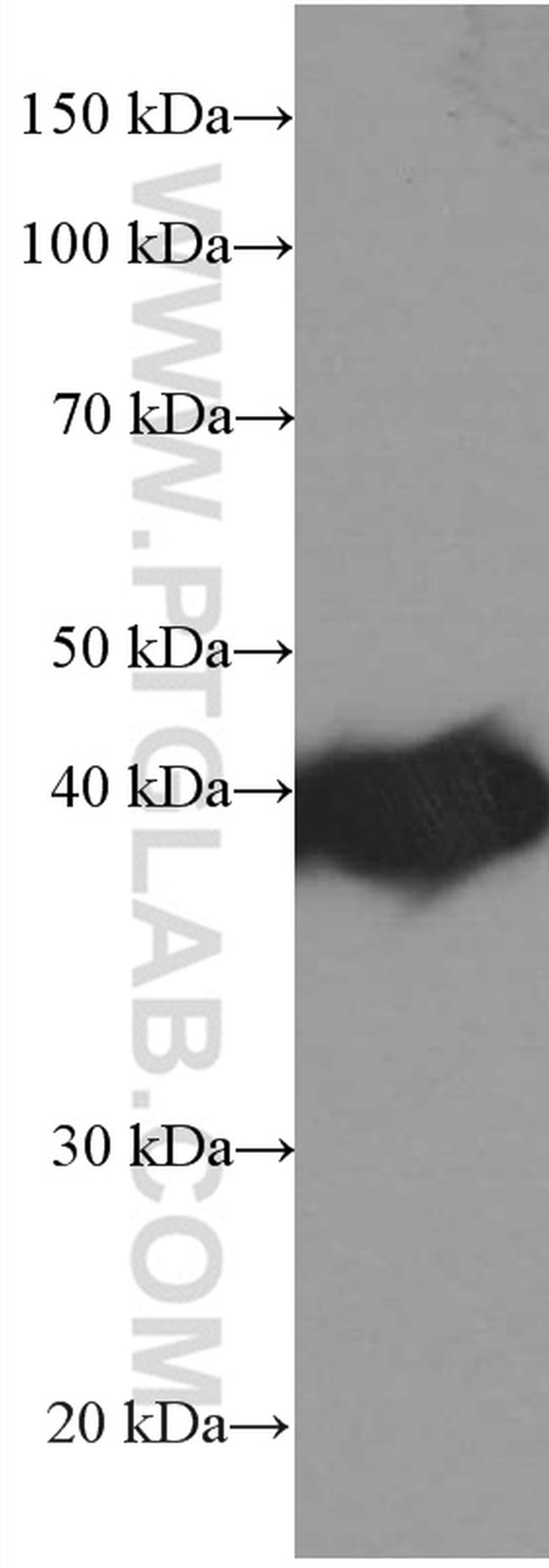 PLEK Antibody in Western Blot (WB)