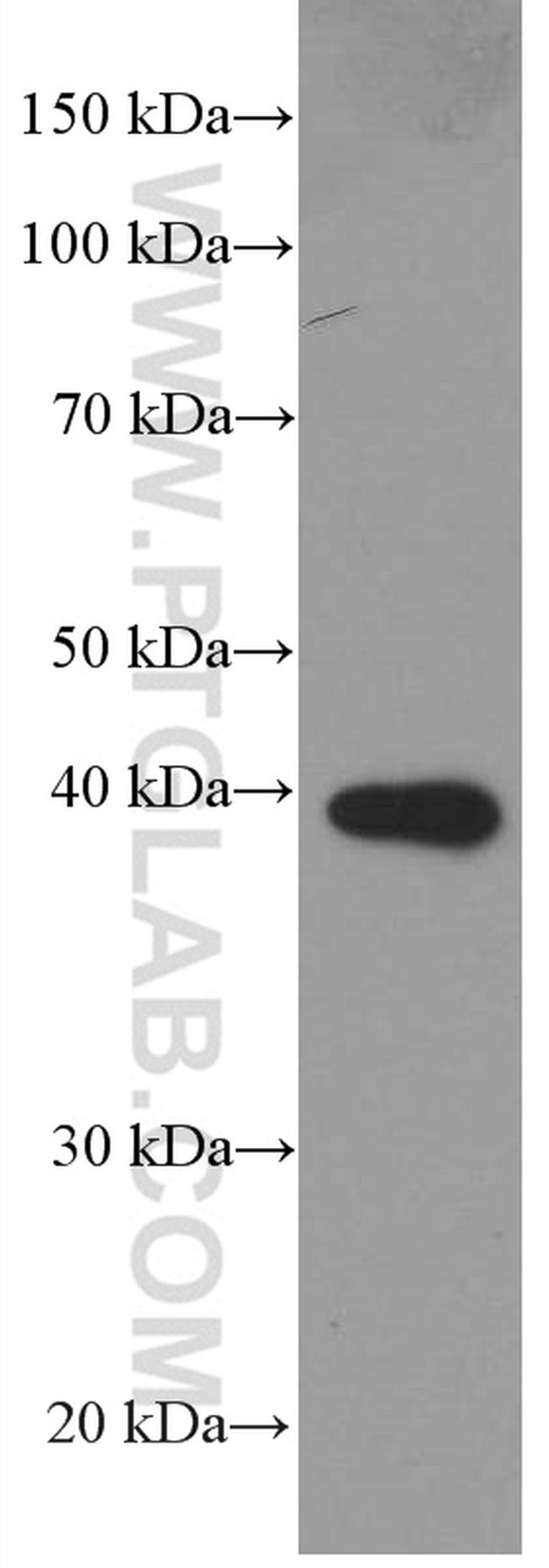 PLEK Antibody in Western Blot (WB)