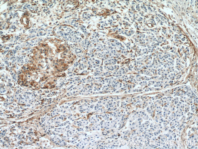 Amphiregulin Antibody in Immunohistochemistry (Paraffin) (IHC (P))