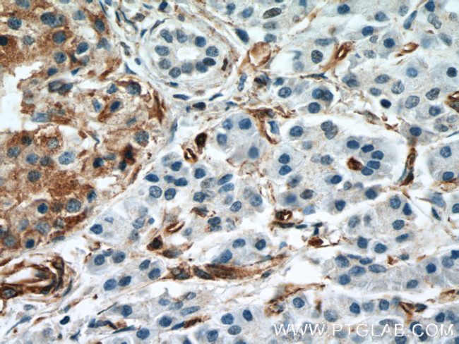 Amphiregulin Antibody in Immunohistochemistry (Paraffin) (IHC (P))