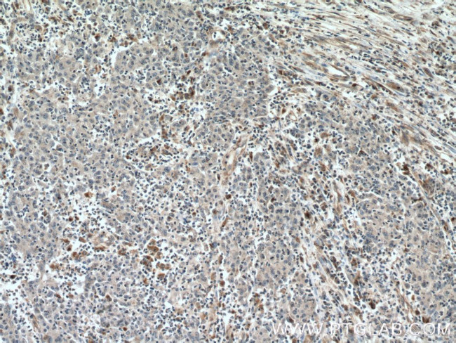 Amphiregulin Antibody in Immunohistochemistry (Paraffin) (IHC (P))