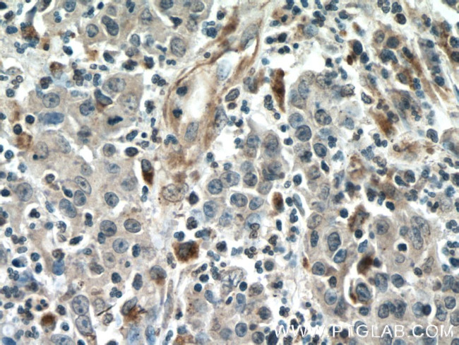 Amphiregulin Antibody in Immunohistochemistry (Paraffin) (IHC (P))