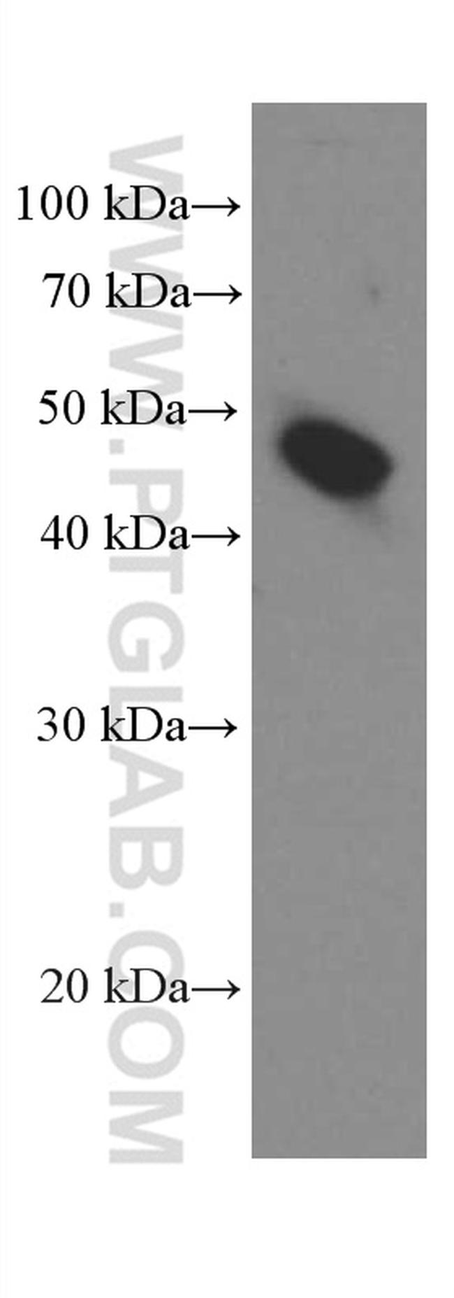 Amphiregulin Antibody in Western Blot (WB)