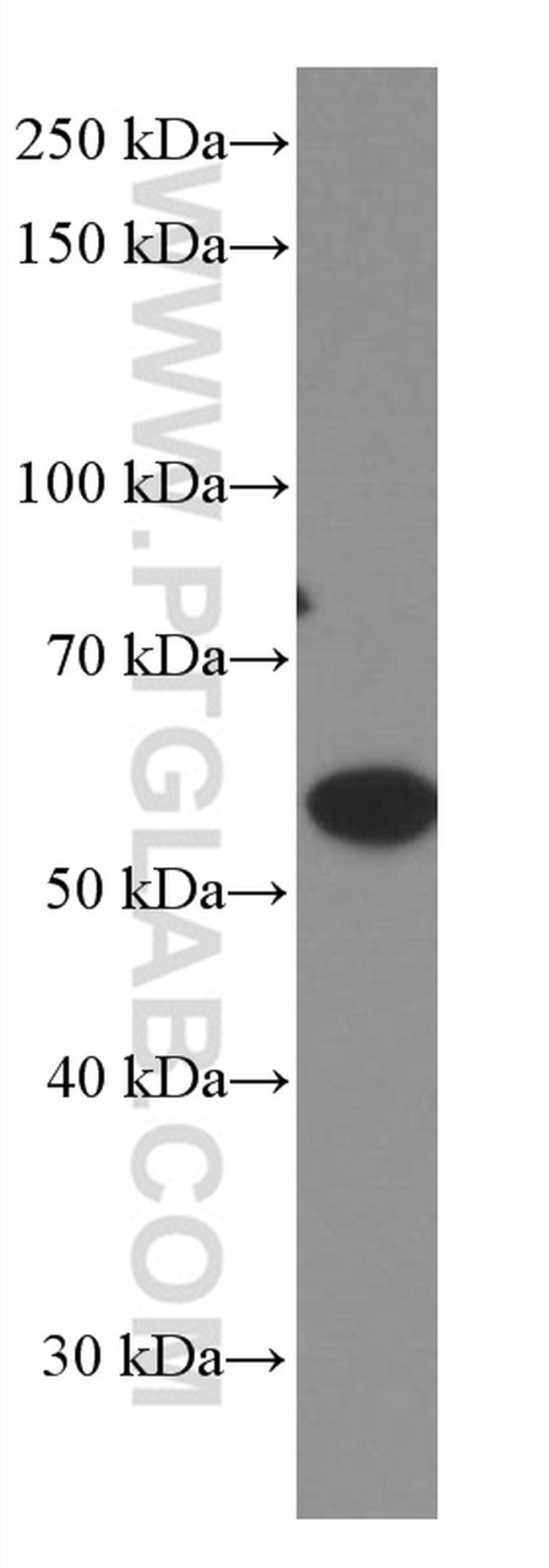 GDI1 Antibody in Western Blot (WB)