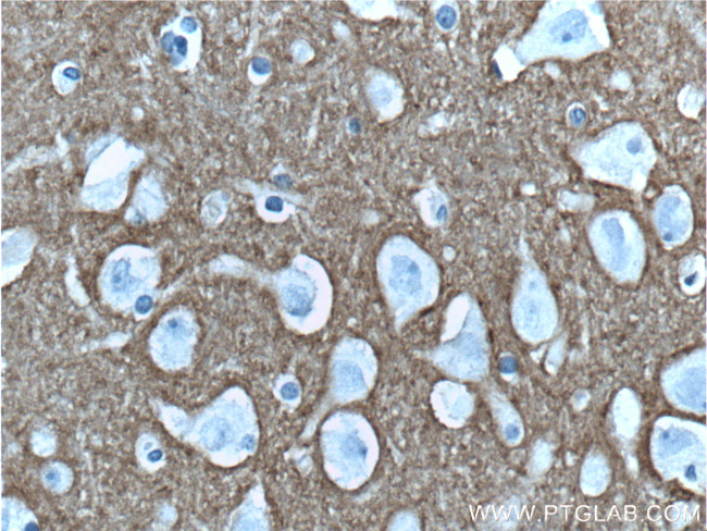 Syntaxin 1A / Syntaxin 1B Antibody in Immunohistochemistry (Paraffin) (IHC (P))