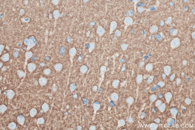 Syntaxin 1A / Syntaxin 1B Antibody in Immunohistochemistry (Paraffin) (IHC (P))