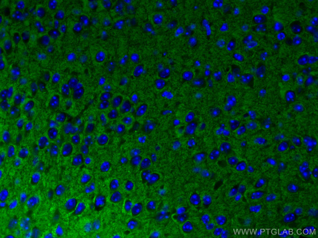 Syntaxin 1A / Syntaxin 1B Antibody in Immunohistochemistry (PFA fixed) (IHC (PFA))