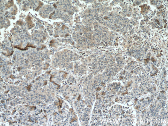 PEBP1 Antibody in Immunohistochemistry (Paraffin) (IHC (P))