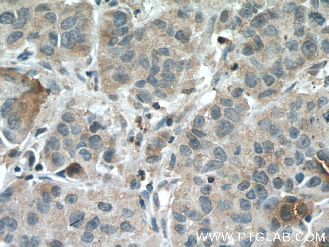 PEBP1 Antibody in Immunohistochemistry (Paraffin) (IHC (P))