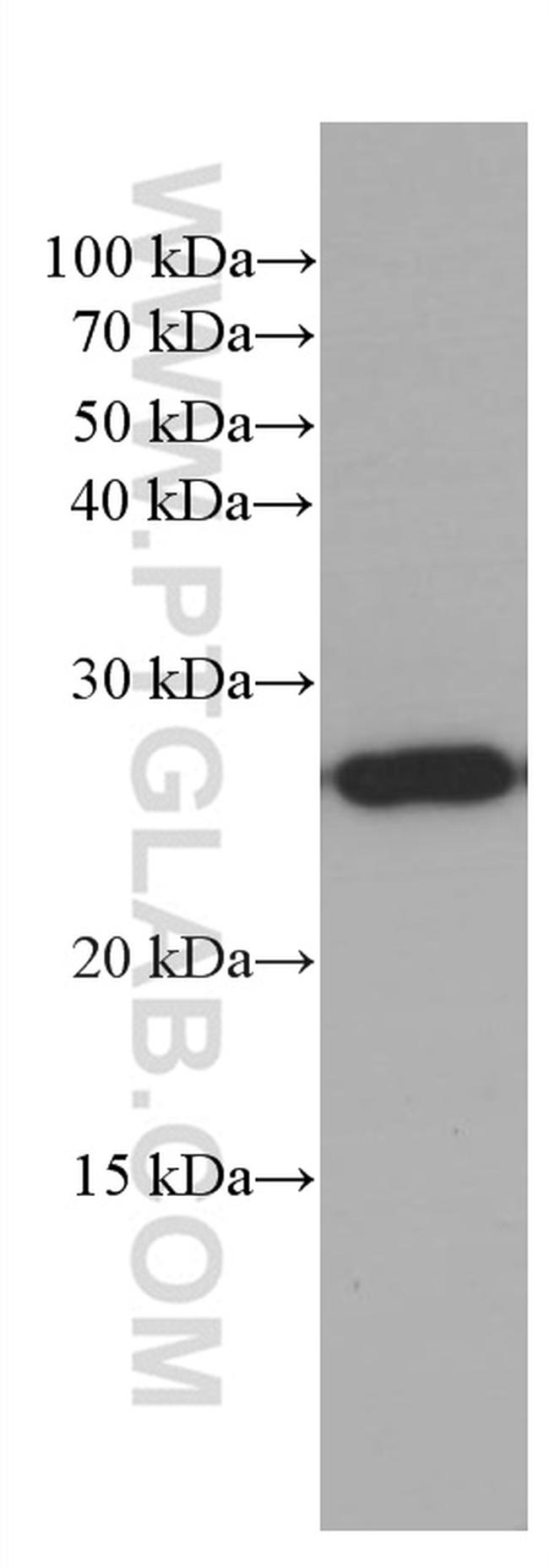 PEBP1 Antibody in Western Blot (WB)