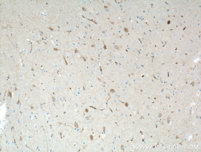 KChIP1 Antibody in Immunohistochemistry (Paraffin) (IHC (P))