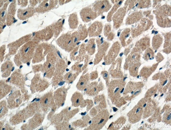 KChIP1 Antibody in Immunohistochemistry (Paraffin) (IHC (P))