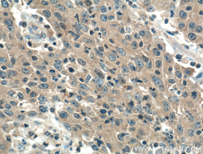 PDCD10 Antibody in Immunohistochemistry (Paraffin) (IHC (P))