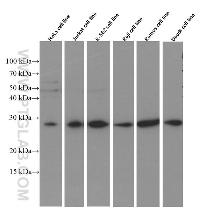 PDCD10 Antibody in Western Blot (WB)