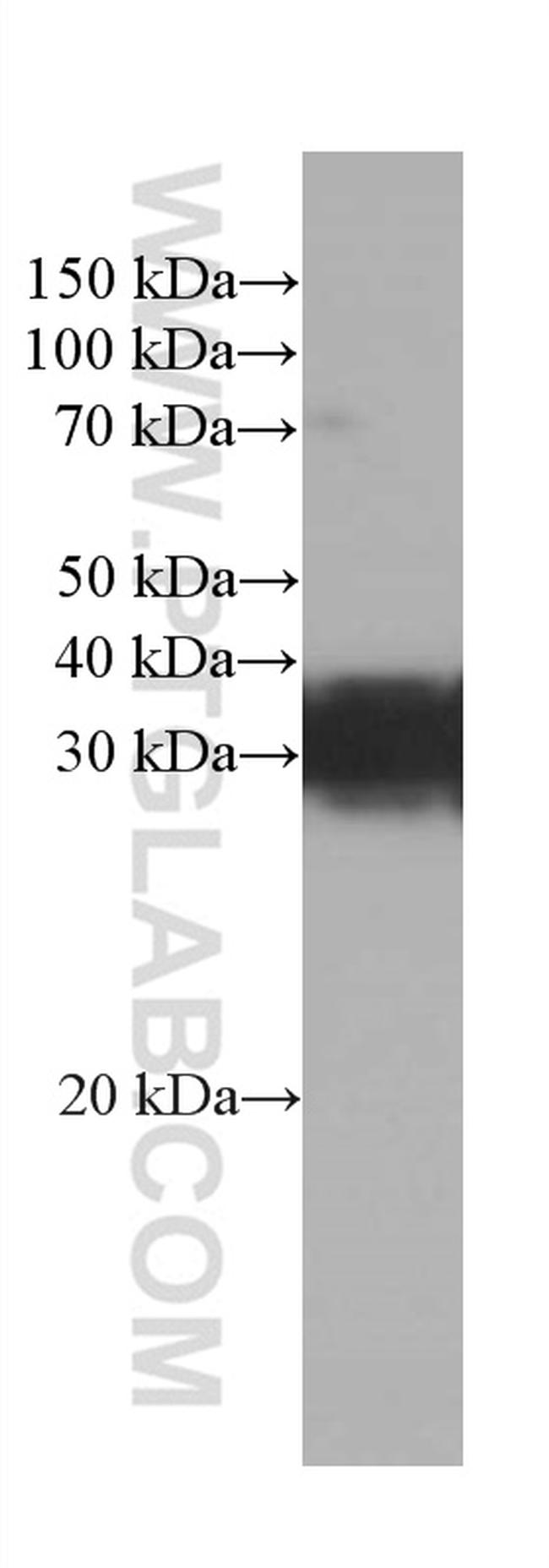 RGS4 Antibody in Western Blot (WB)