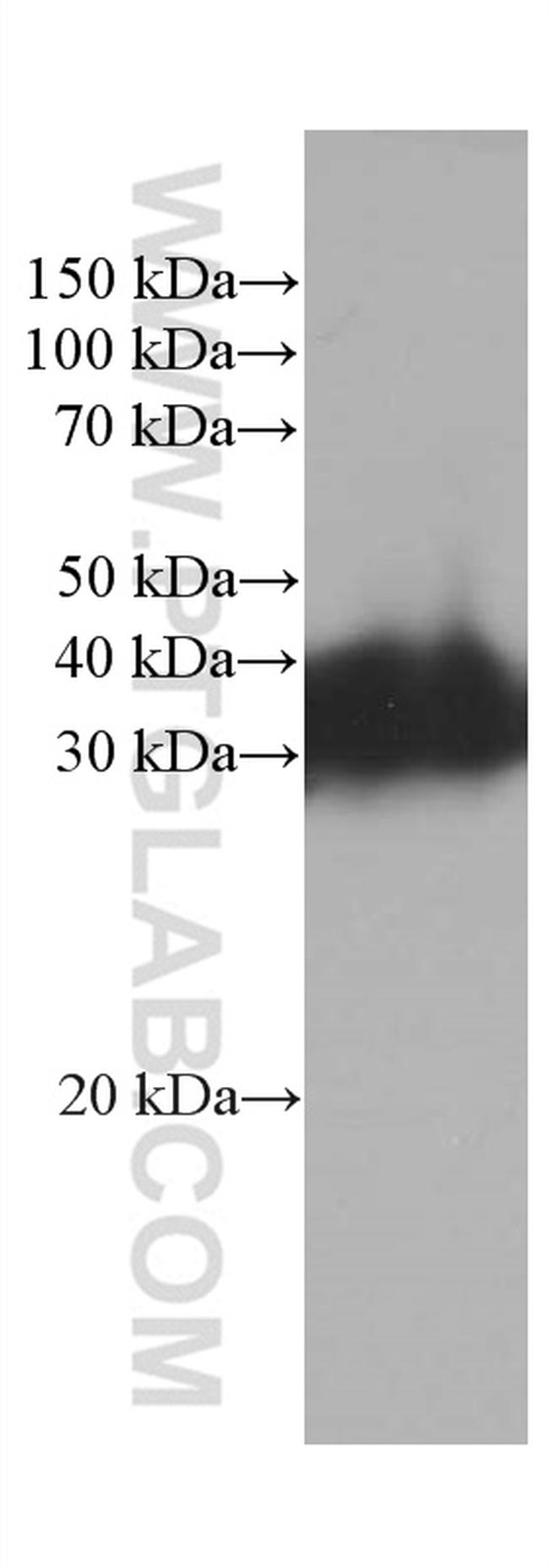 RGS4 Antibody in Western Blot (WB)