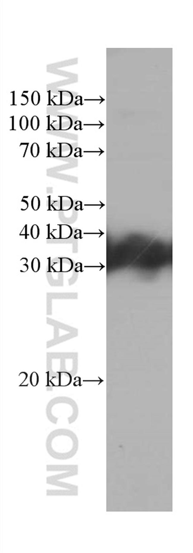 RGS4 Antibody in Western Blot (WB)