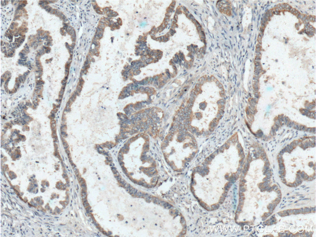 Hsc70 Antibody in Immunohistochemistry (Paraffin) (IHC (P))