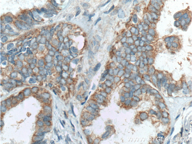 Hsc70 Antibody in Immunohistochemistry (Paraffin) (IHC (P))