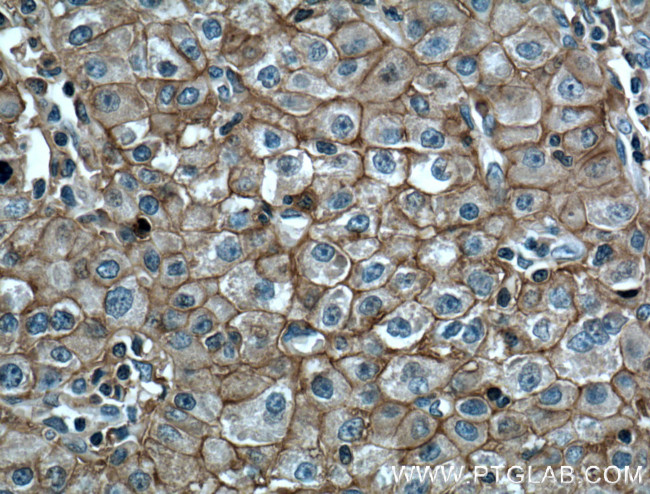 CD147 Antibody in Immunohistochemistry (Paraffin) (IHC (P))