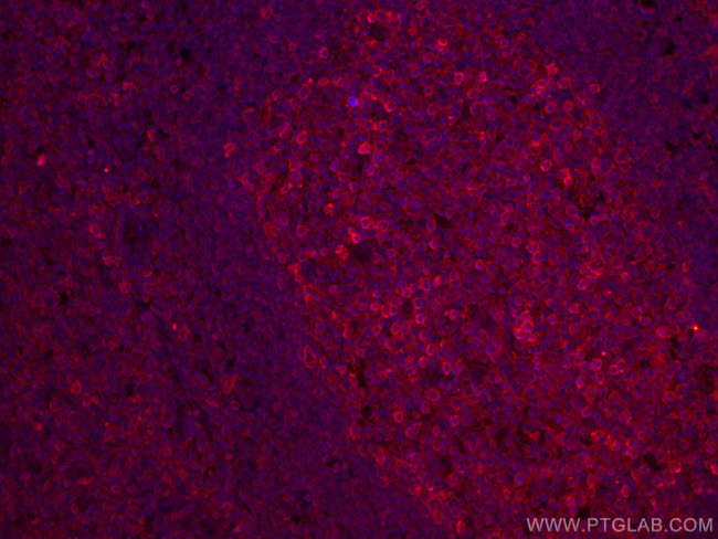 CD147 Antibody in Immunohistochemistry (PFA fixed) (IHC (PFA))