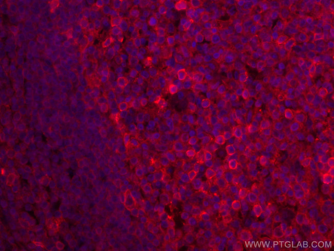 CD147 Antibody in Immunohistochemistry (PFA fixed) (IHC (PFA))