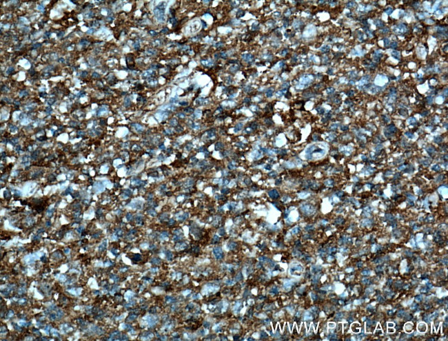 CD147 Antibody in Immunohistochemistry (Paraffin) (IHC (P))