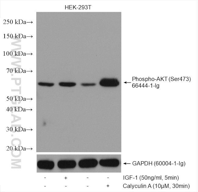 Phospho-AKT (Ser473) Antibody in Western Blot (WB)