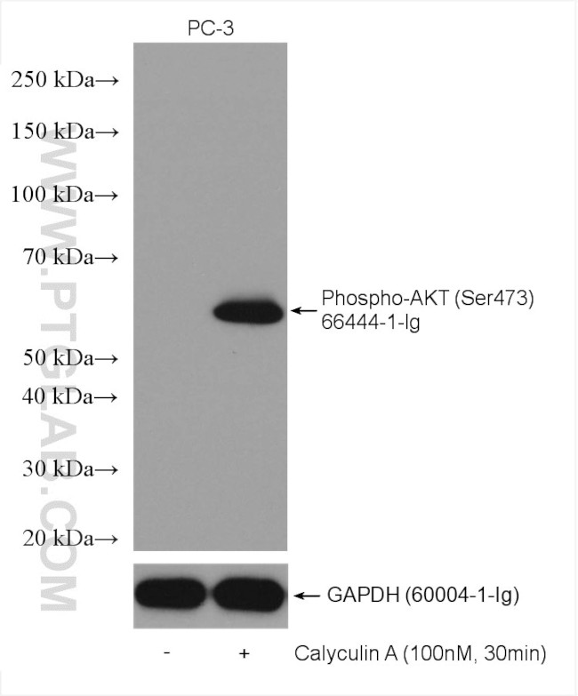 Phospho-AKT (Ser473) Antibody in Western Blot (WB)