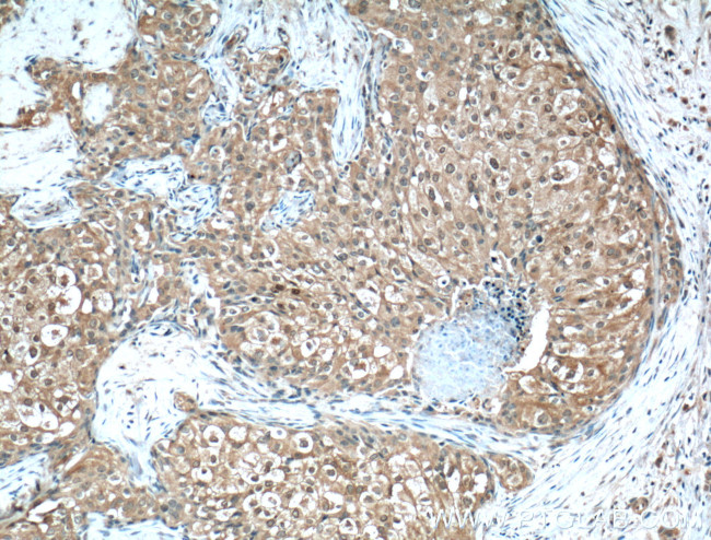 Phospho-AKT (Ser473) Antibody in Immunohistochemistry (Paraffin) (IHC (P))