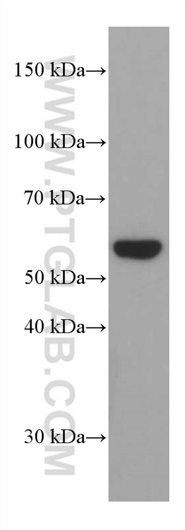 Phospho-AKT (Ser473) Antibody in Western Blot (WB)