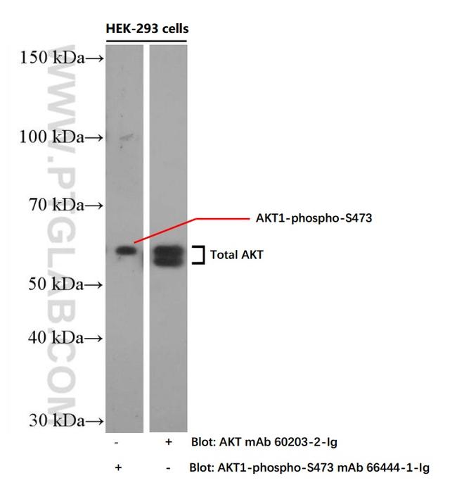 Phospho-AKT (Ser473) Antibody in Western Blot (WB)