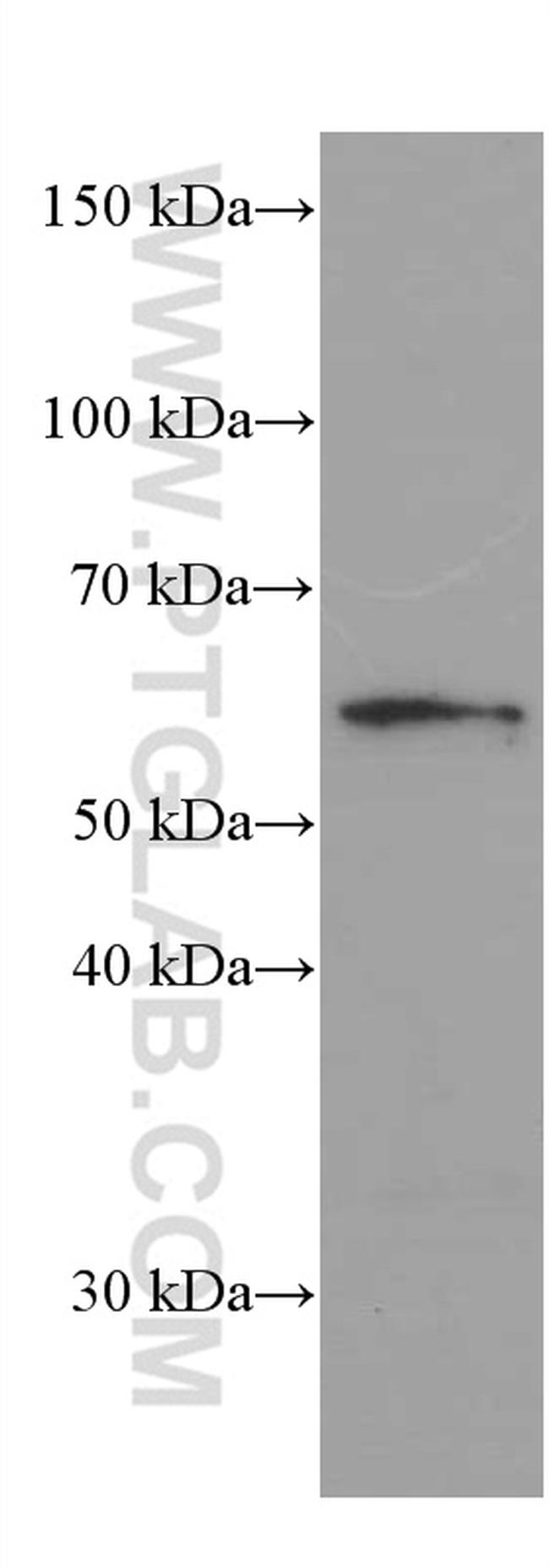 Phospho-AKT (Ser473) Antibody in Western Blot (WB)