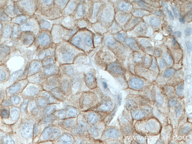 gamma catenin Antibody in Immunohistochemistry (Paraffin) (IHC (P))