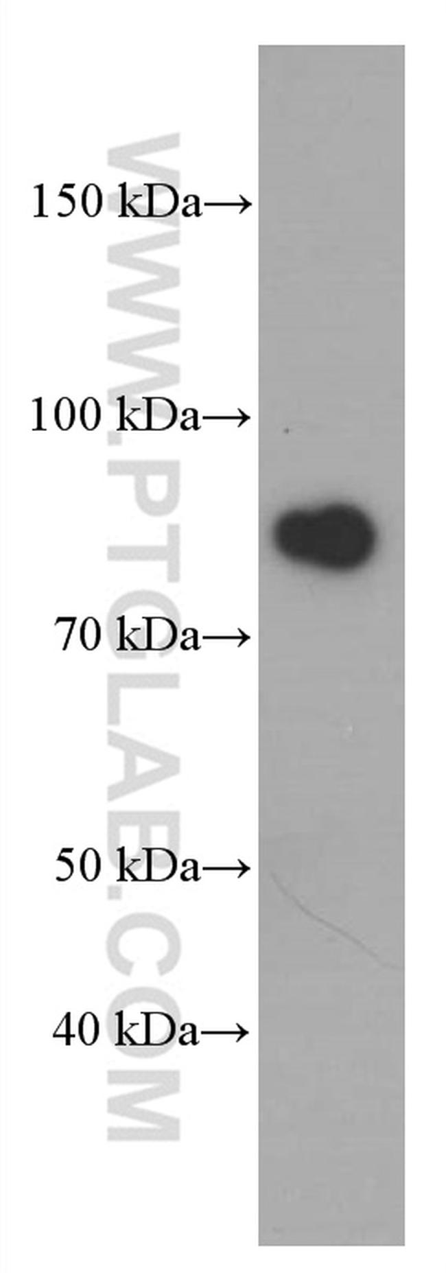 gamma catenin Antibody in Western Blot (WB)