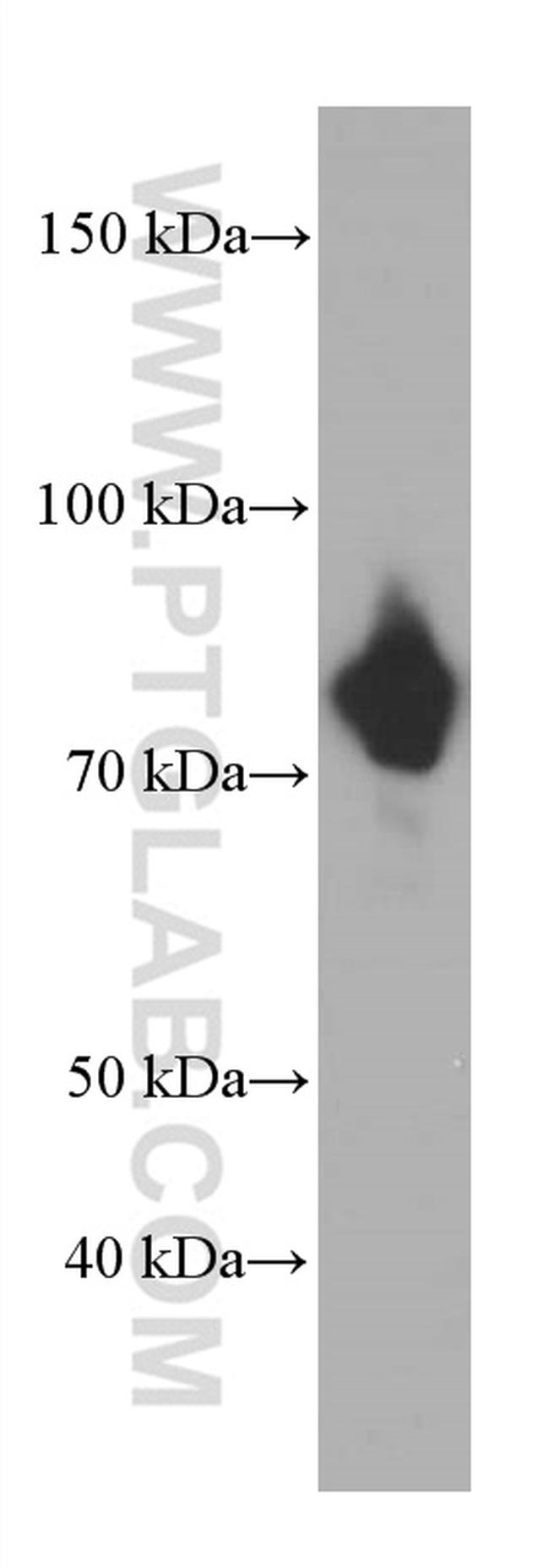 gamma catenin Antibody in Western Blot (WB)