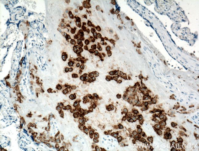 HLA-G Antibody in Immunohistochemistry (Paraffin) (IHC (P))