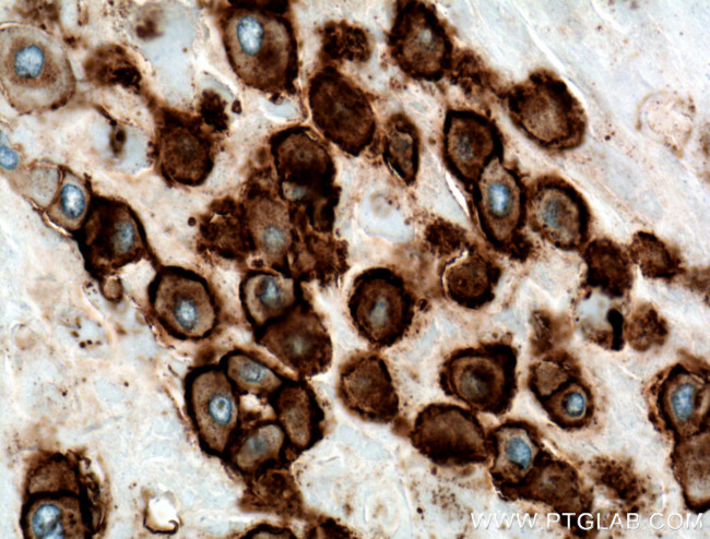 HLA-G Antibody in Immunohistochemistry (Paraffin) (IHC (P))