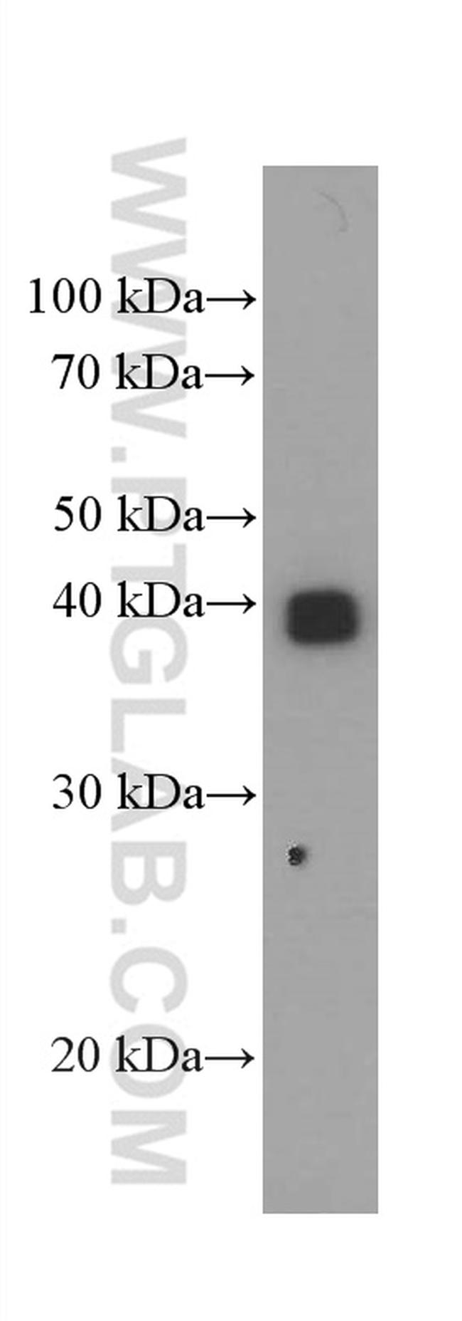 HLA-G Antibody in Western Blot (WB)