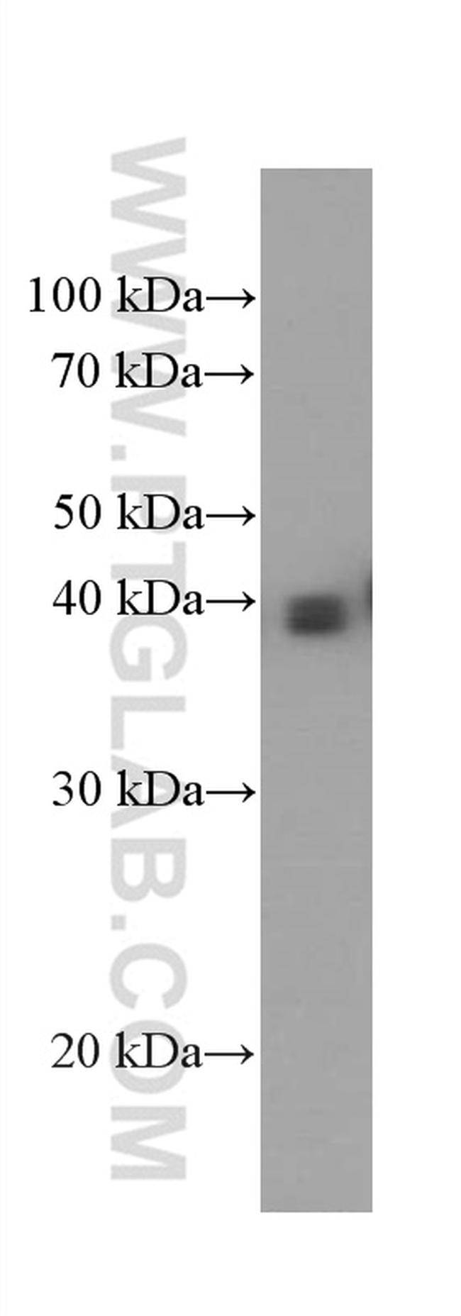 HLA-G Antibody in Western Blot (WB)