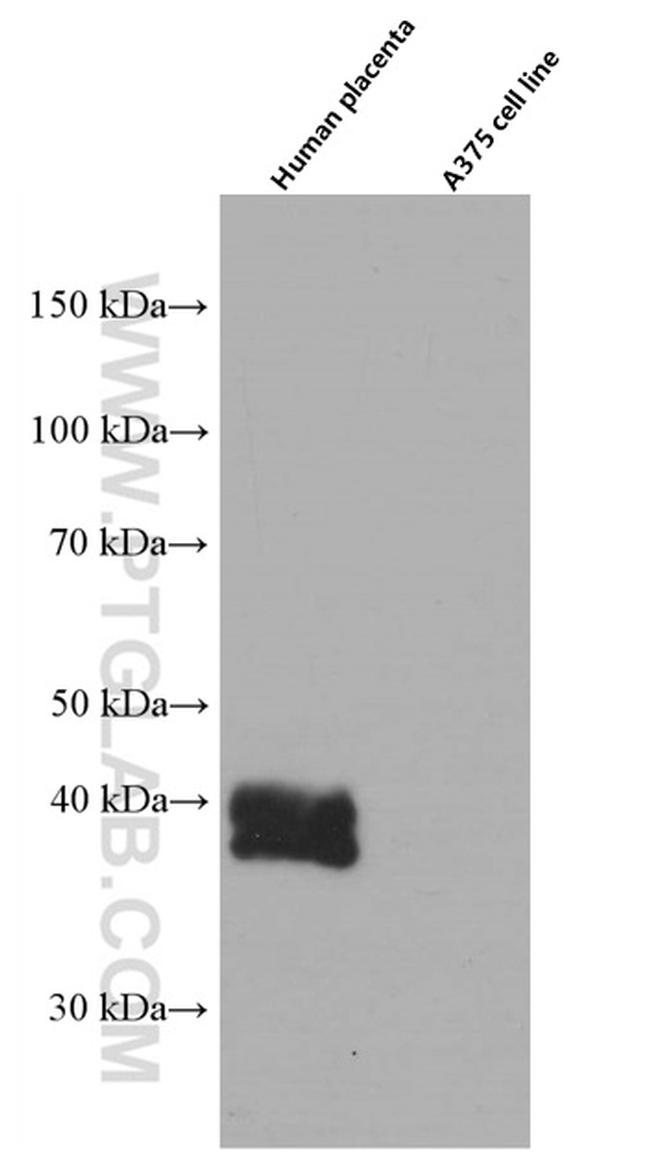 HLA-G Antibody in Western Blot (WB)